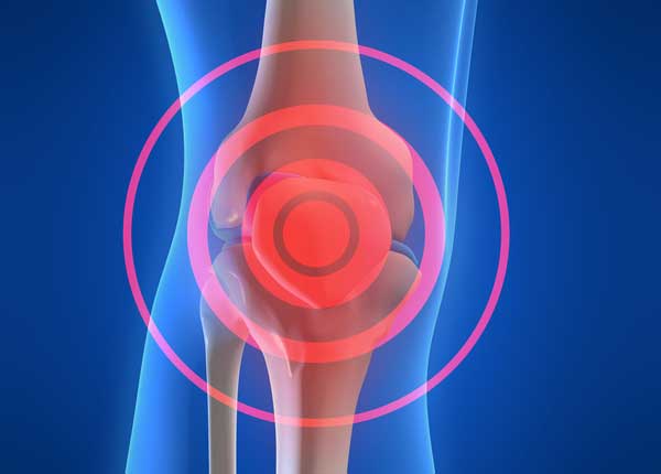 Rotura De Ligamento Cruzado Anterior Una De Las Lesiones M S Frecuentes De La Rodilla